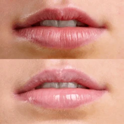 Lip Spa Lip Serum -Pet Shop PINKLIPSPA d091c5da 0725 446d aa37 0e0d2e453546